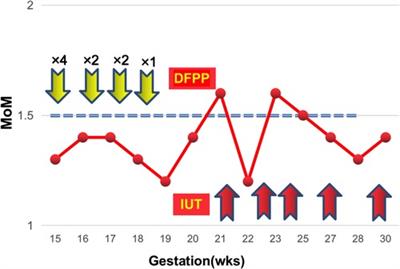 Maternal And Fetal Factors Influencing Fetal Fraction A Retrospective