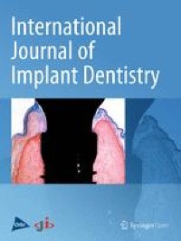 Chairside 3-D printed impression trays: a new approach to increase the accuracy of conventional implant impression taking? An in vitro study