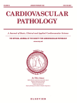 Sudden unexpected death of a young adult due to subarachnoid hemorrhage associated with polyarteritis nodosa: Clinicopathological appearance and literature review