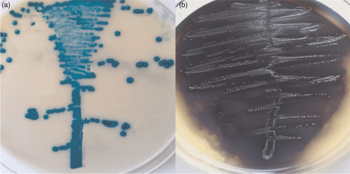 Occurrence of bone sialoprotein-binding protein gene among clinical vancomycin-resistant Enterococcus faecium isolated from bone infections