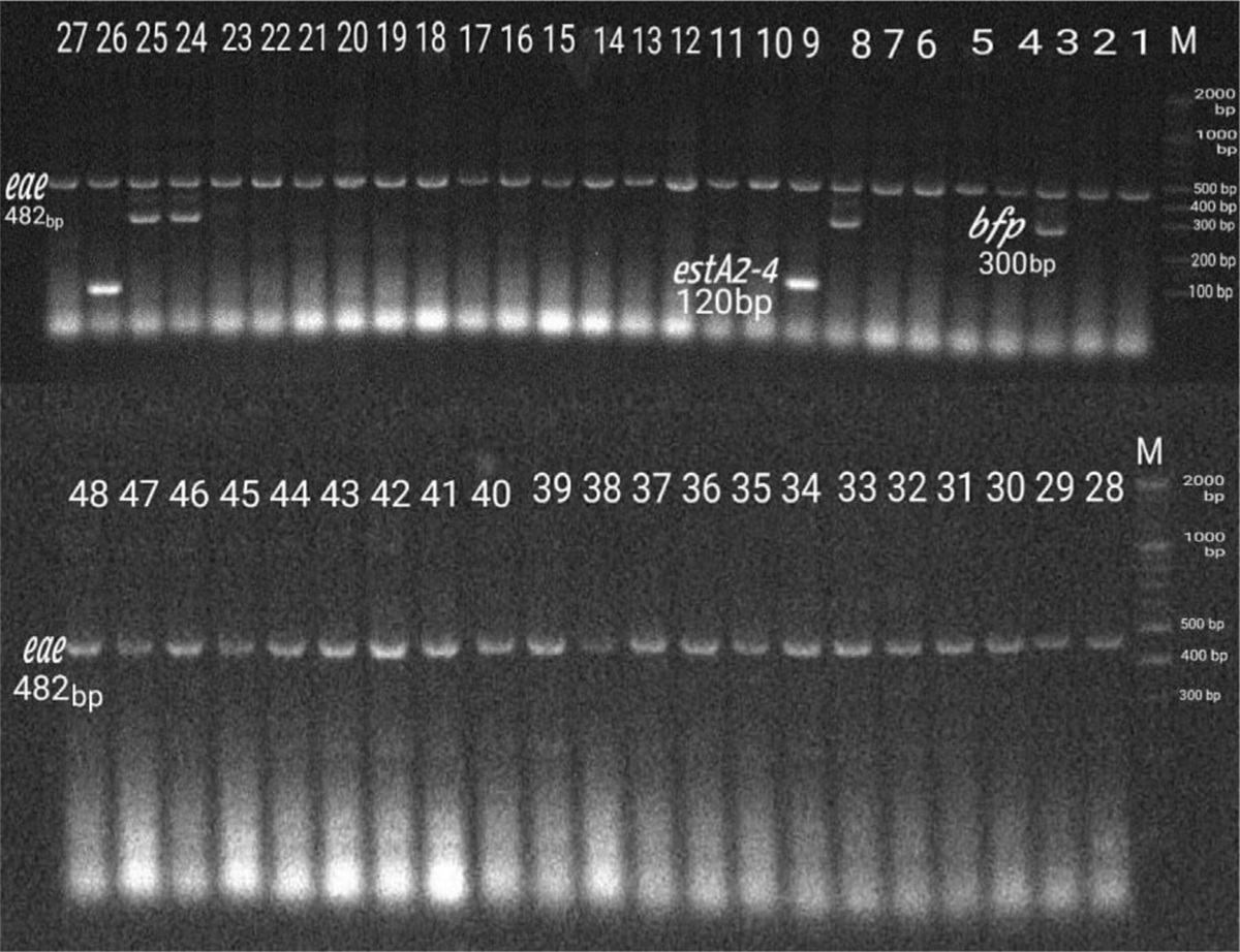 Identification, differentiation and phylogenetic typing of diarrheagenic Escherichia coli in Iraqi infants and children