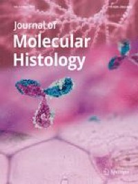 LRRC1 knockdown downregulates MACF1 to inhibit the malignant progression of acute myeloid leukemia by inactivating β-catenin/c-Myc signaling