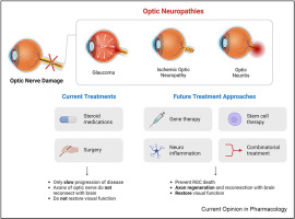 Optic nerve regeneration: Potential treatment approaches