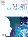 Amygdala biomarkers of treatment response in major depressive disorder: An fMRI systematic review of SSRI antidepressants