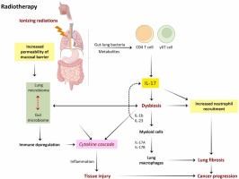 Targeting Interleukin-17 in Radiation-Induced Toxicity and Cancer Progression