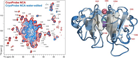 Solid-state NMR MAS CryoProbe enables structural studies of human blood protein vitronectin bound to hydroxyapatite