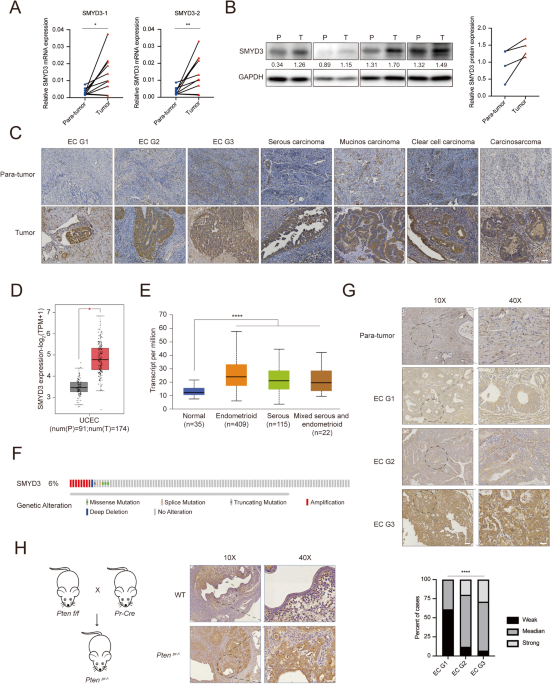 SMYD3 promotes endometrial cancer through epigenetic regulation of LIG4/XRCC4/XLF complex in non-homologous end joining repair