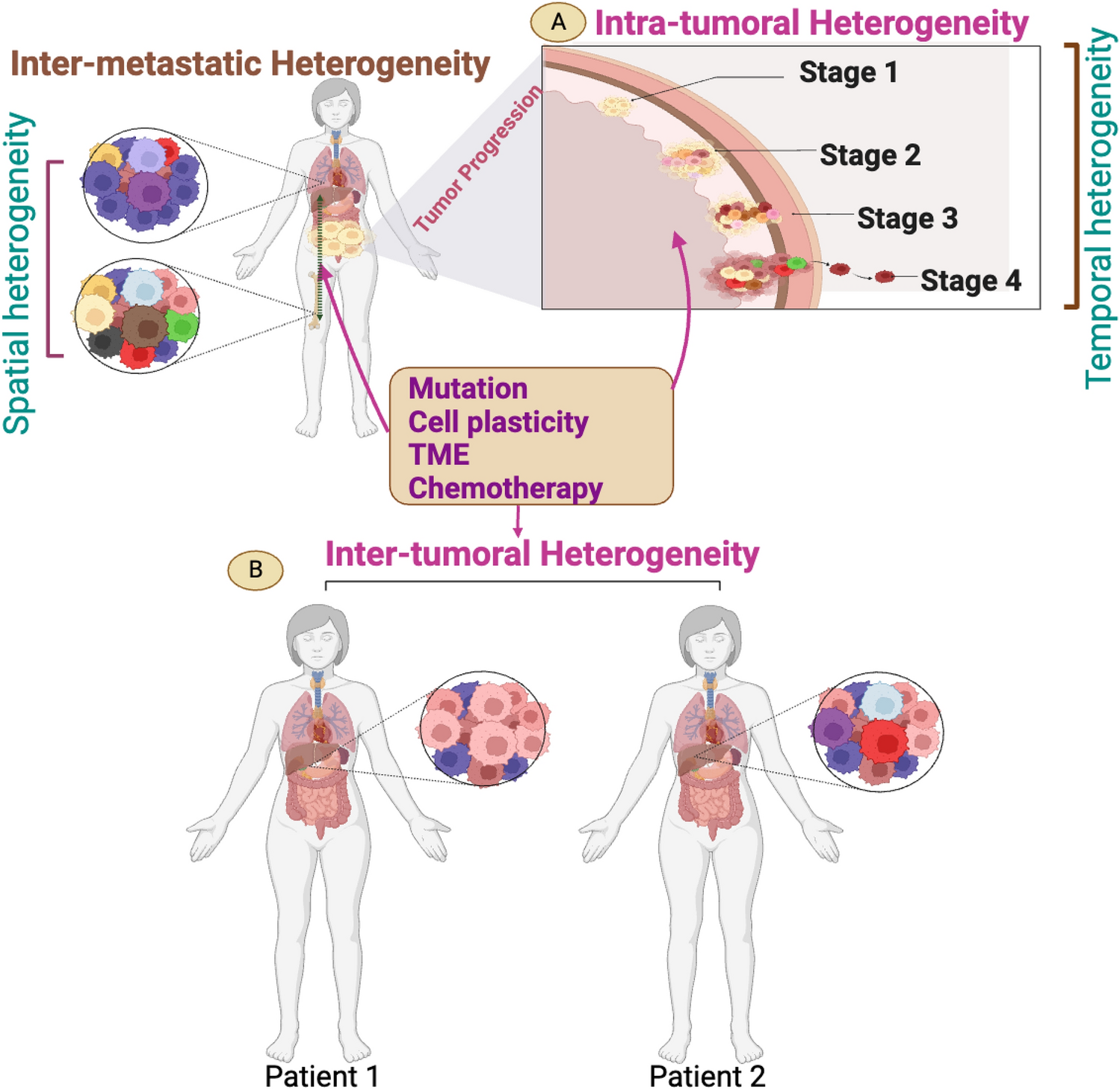 From complexity to clarity: unravelling tumor heterogeneity through the lens of tumor microenvironment for innovative cancer therapy