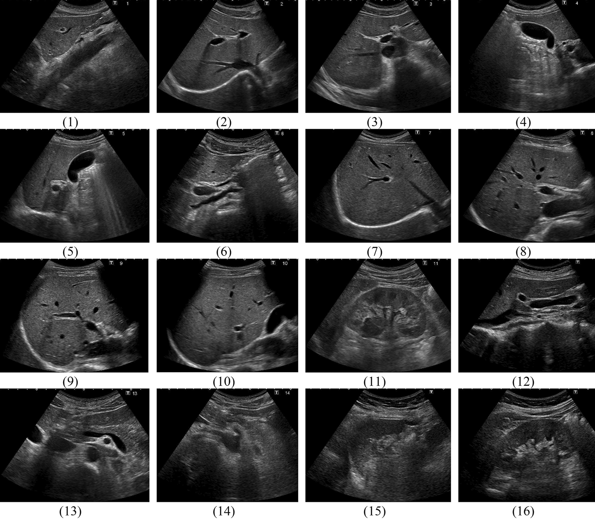 Analysis of neural networks for routine classification of sixteen ultrasound upper abdominal cross sections