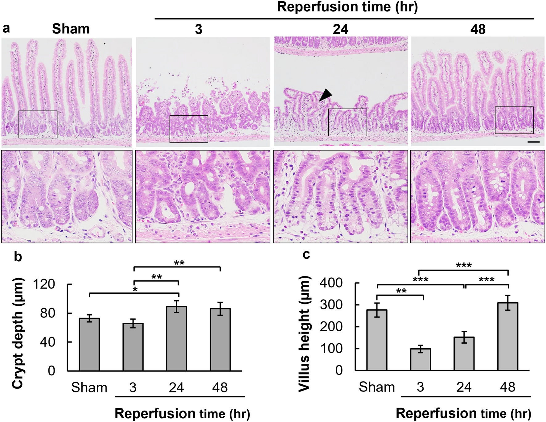 The crucial role of SETDB1 in structural and functional transformation of epithelial cells during regeneration after intestinal ischemia reperfusion injury