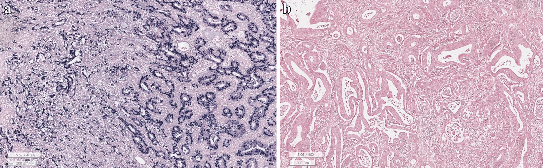 Sex-dependent different clinicopathological characterization of Epstein–Barr virus-associated gastric carcinoma: a large-scale study