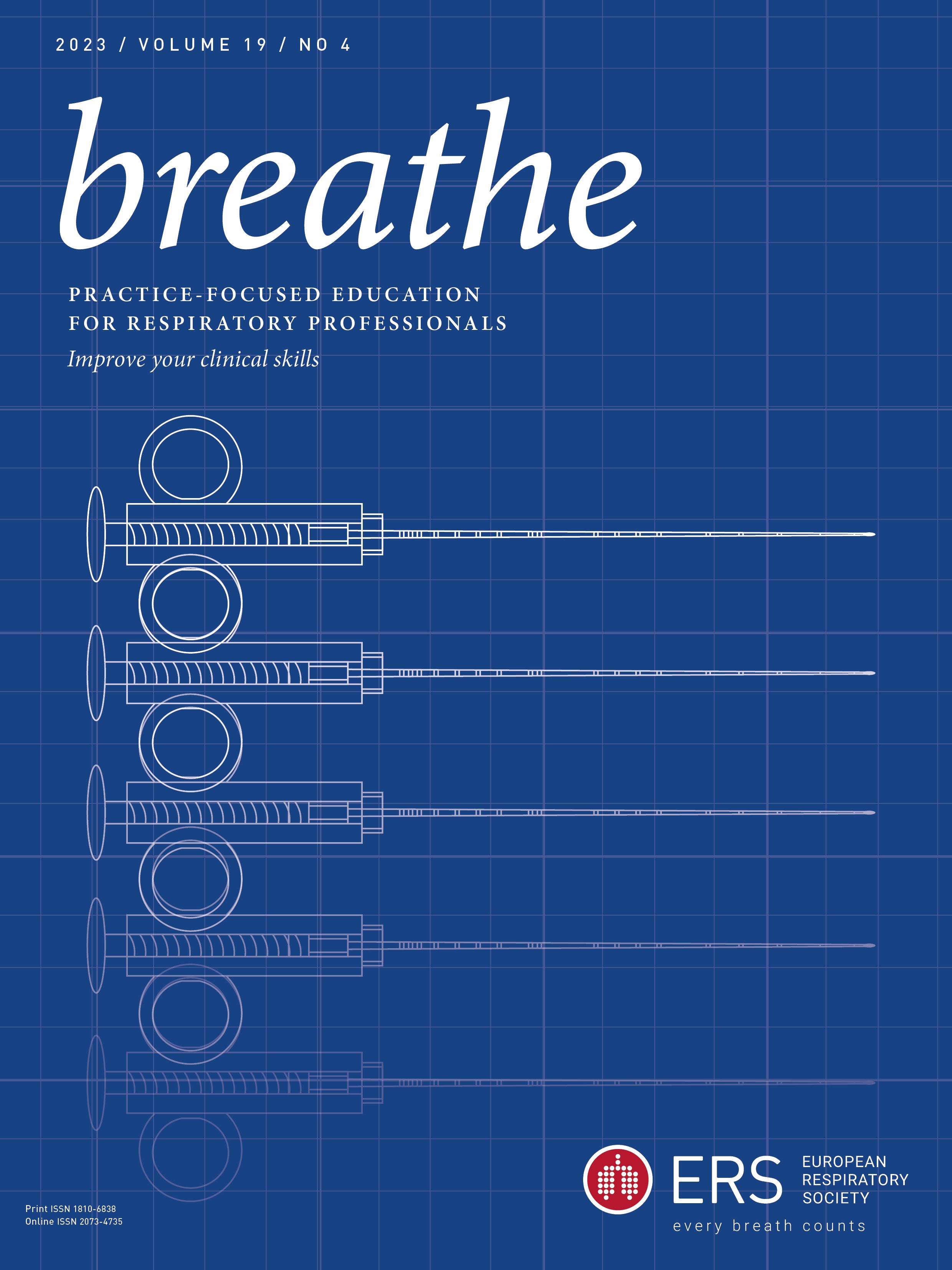 The contemporary management of spontaneous pneumothorax in adults
