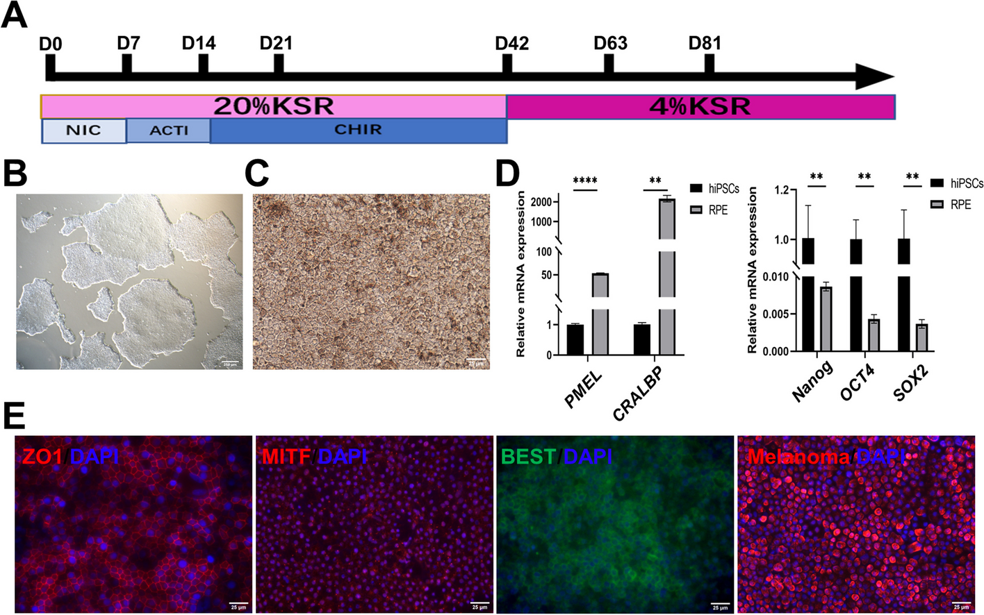 Tissue engineering RPE sheet derived from hiPSC-RPE cell spheroids supplemented with Y-27632 and RepSox
