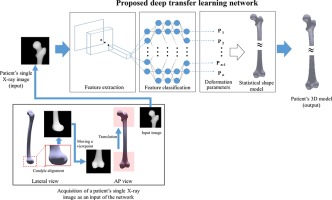 2D-3D Reconstruction of a Femur by Single X-Ray Image Based on Deep Transfer Learning Network