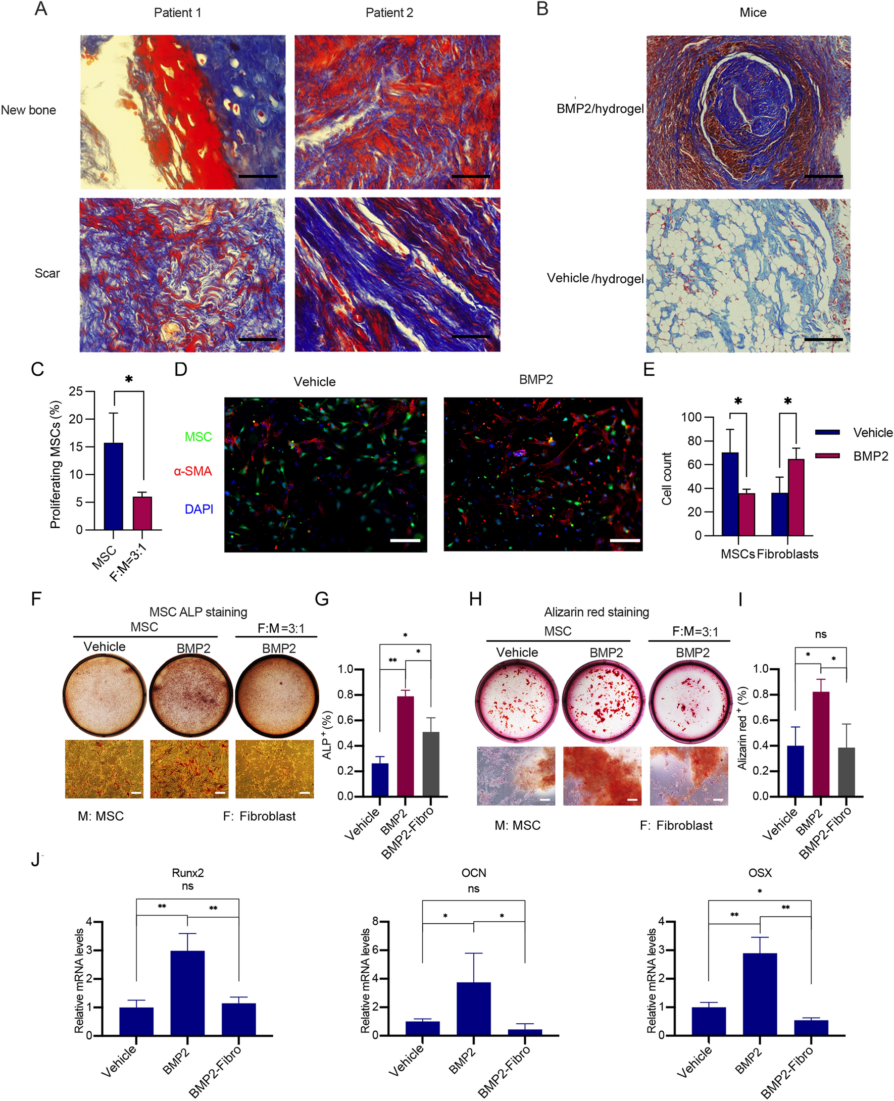 Fibroblasts inhibit osteogenesis by regulating nuclear-cytoplasmic shuttling of YAP in mesenchymal stem cells and secreting DKK1