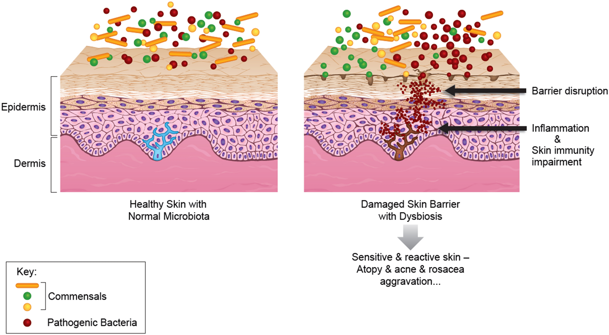 The Skin Microbiome and its Significance for Dermatologists