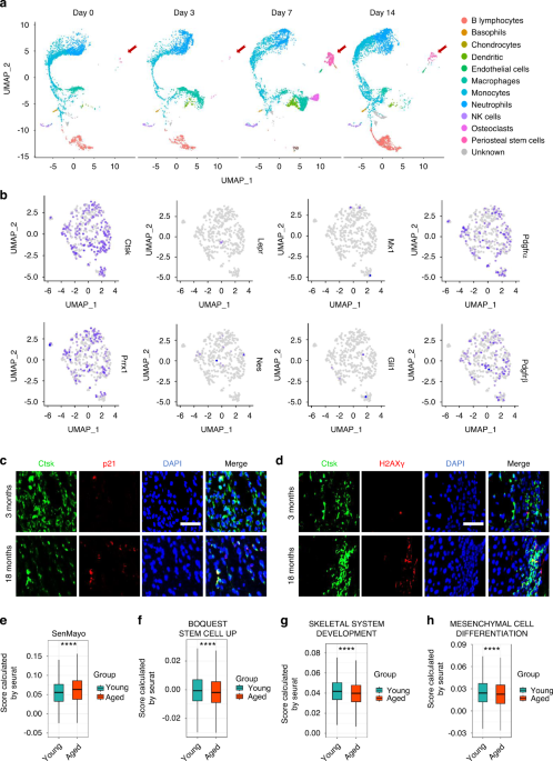 Age-related secretion of grancalcin by macrophages induces skeletal stem/progenitor cell senescence during fracture healing
