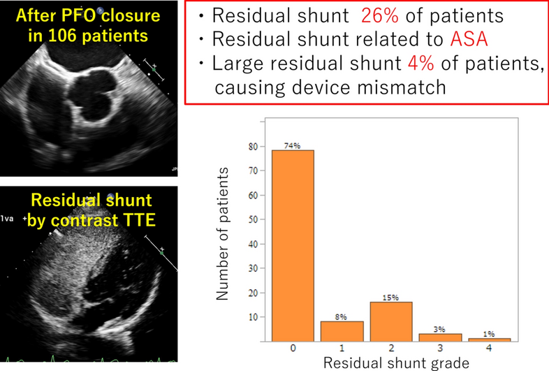 Relationship between patent foramen ovale anatomical features and residual shunt after patent foramen ovale closure