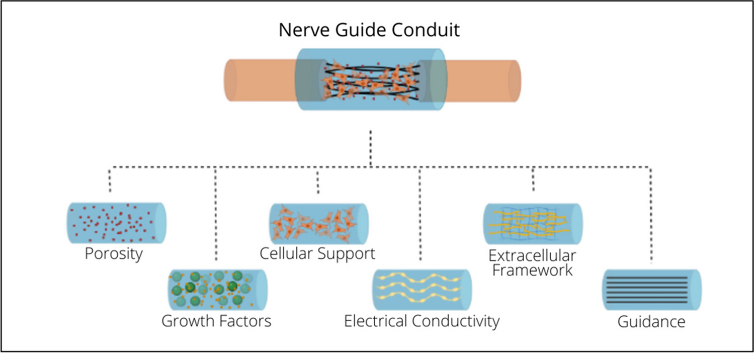 Electroactive Conduits for Neuroregeneration: A Step Ahead