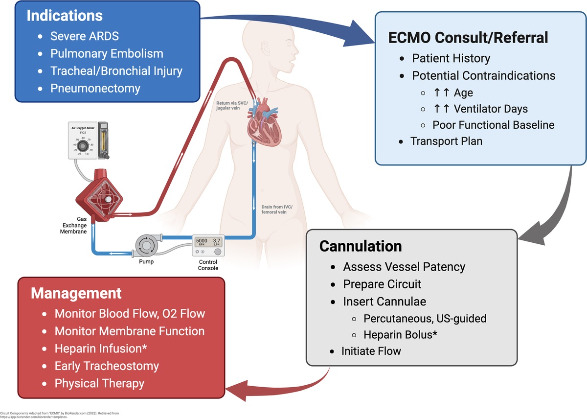 ECMO in trauma care: What you need to know