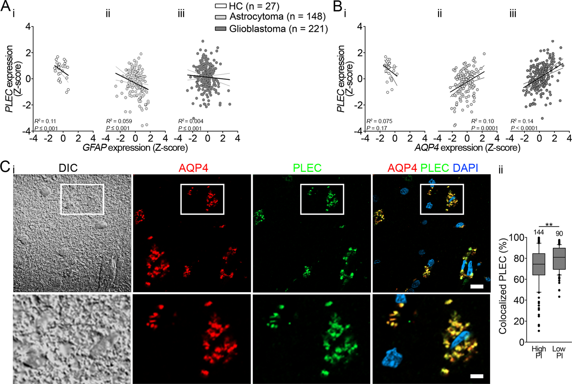 Plectin plays a role in the migration and volume regulation of astrocytes: a potential biomarker of glioblastoma