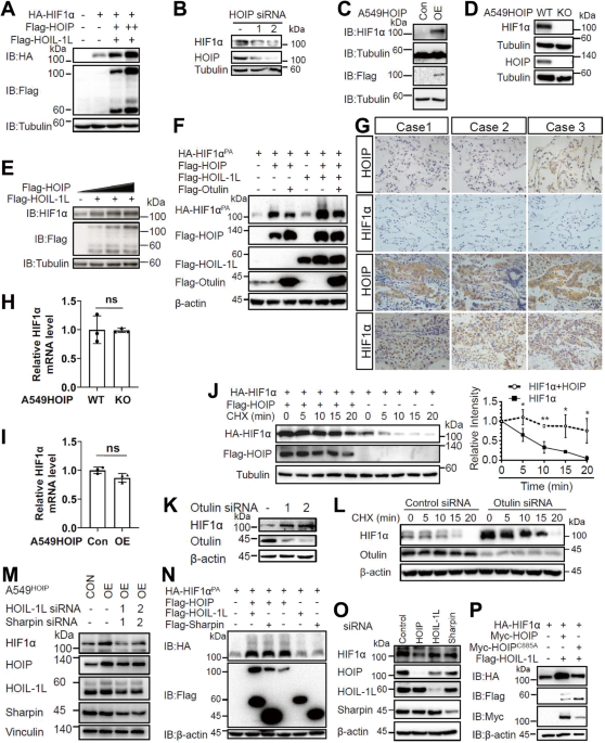 LUBAC promotes angiogenesis and lung tumorigenesis by ubiquitinating and antagonizing autophagic degradation of HIF1α