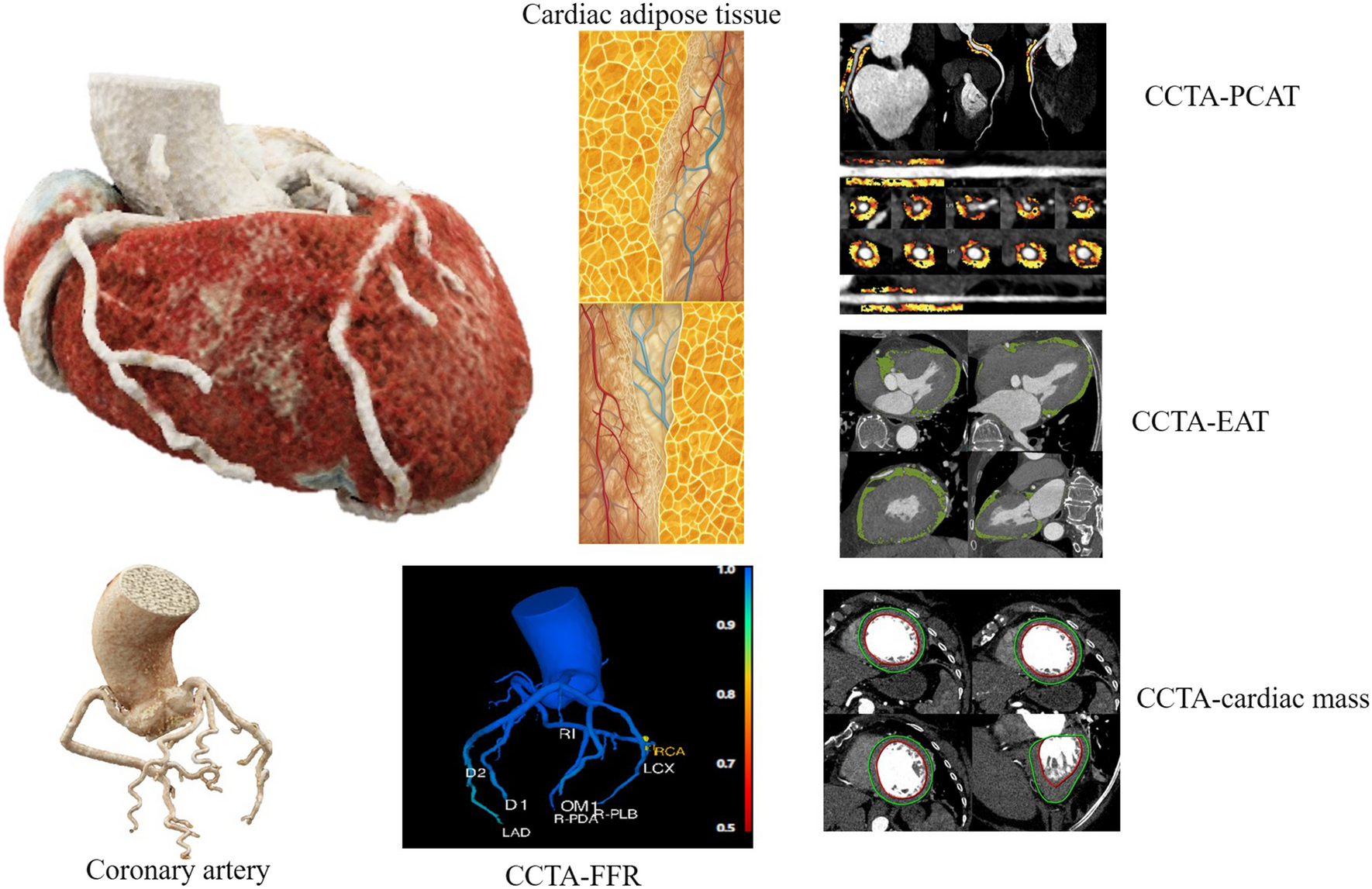 The Role of CCTA-derived Cardiac Structure and Function Analysis in the Prediction of Readmission in Nonischemic Heart Failure