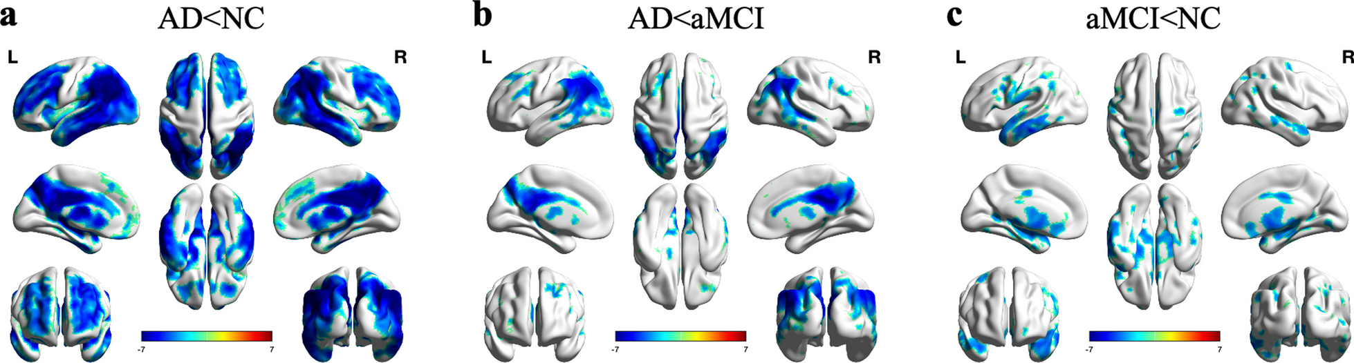 Comparison of 18F-FDG PET and arterial spin labeling MRI in evaluating Alzheimer’s disease and amnestic mild cognitive impairment using integrated PET/MR