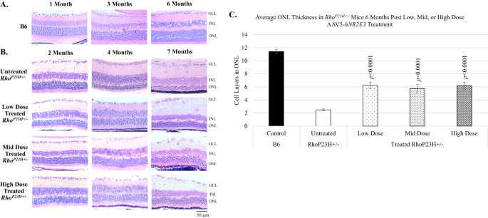 Preclinical dose response study shows NR2E3 can attenuate retinal degeneration in the retinitis pigmentosa mouse model RhoP23H+/−