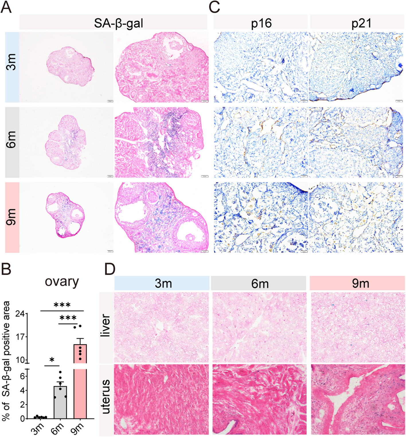 Chitosan alleviates ovarian aging by enhancing macrophage phagocyte-mediated tissue homeostasis
