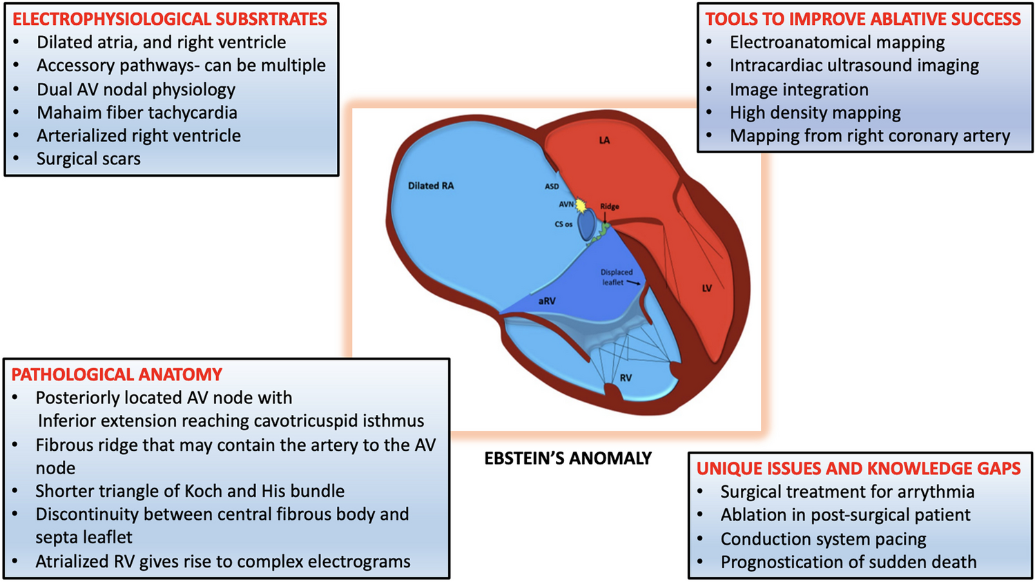 Ebstein’s anomaly: an electrophysiological perspective