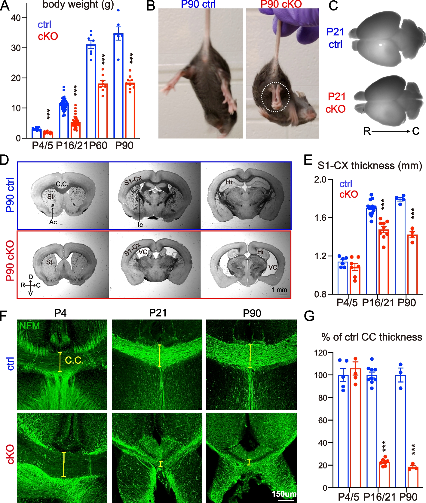 NMNAT2 supports vesicular glycolysis via NAD homeostasis to fuel fast axonal transport
