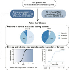 Immunosuppression induces regression of fibrosis in primary biliary cholangitis with moderate-to-severe interface hepatitis