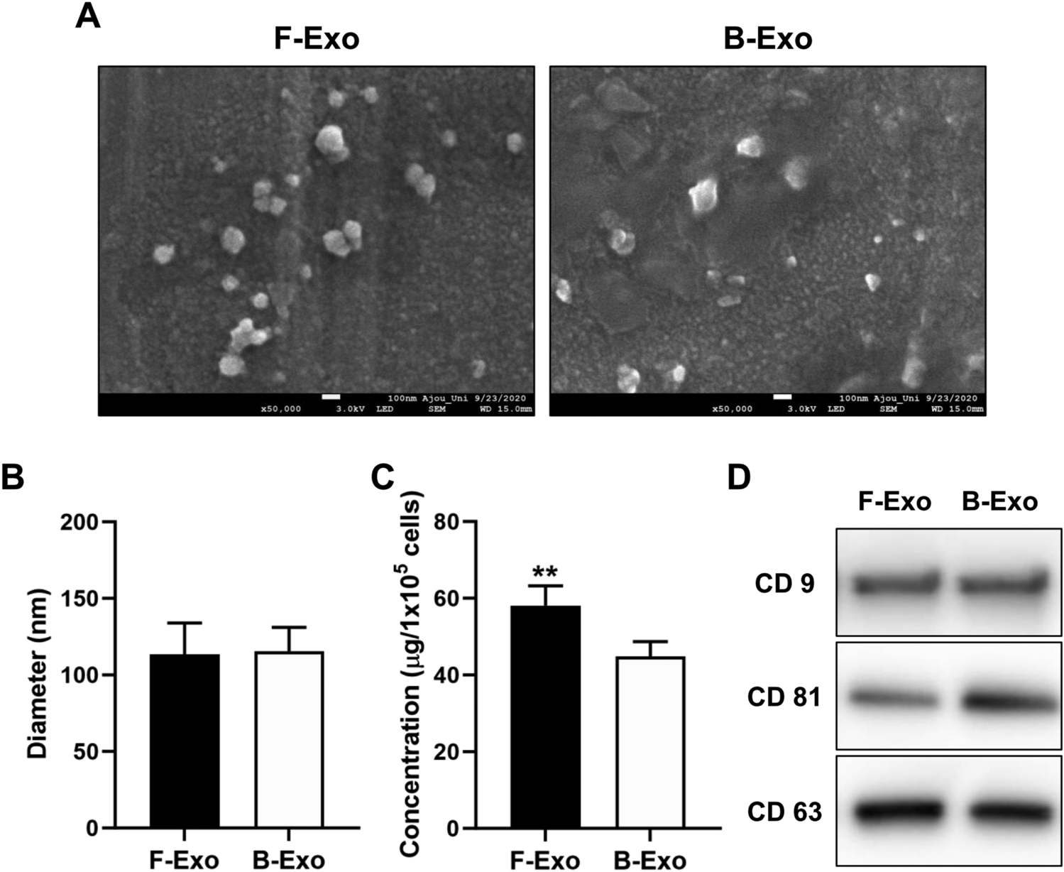 Exosomes Secreted During Myogenic Differentiation of Human Fetal Cartilage-Derived Progenitor Cells Promote Skeletal Muscle Regeneration through miR-145-5p