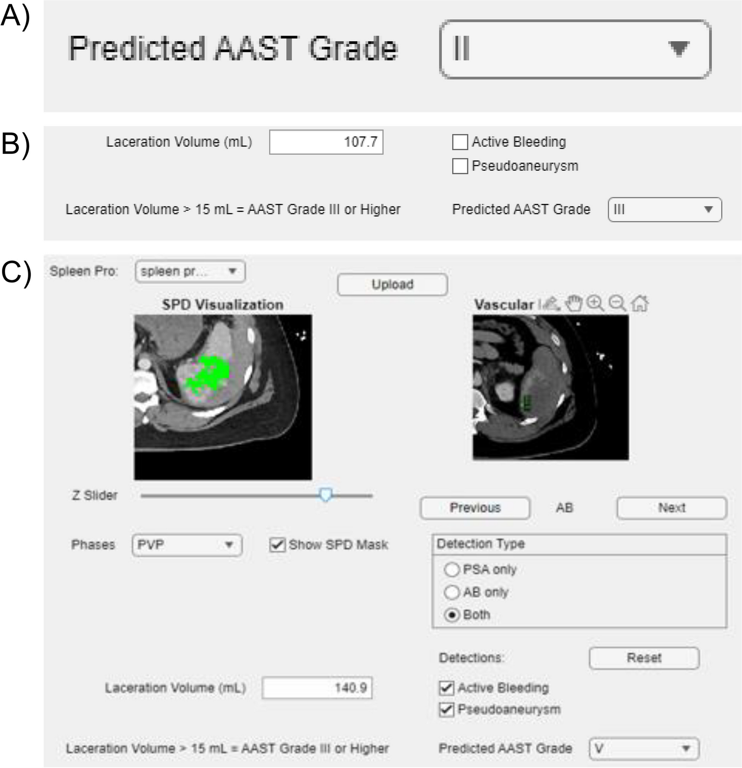 An ASER AI/ML expert panel formative user research study for an interpretable interactive splenic AAST grading graphical user interface prototype