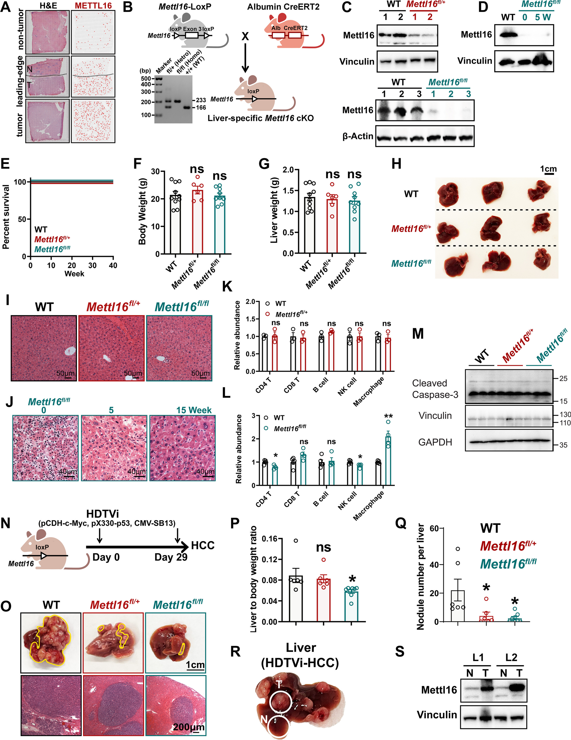 METTL16 promotes liver cancer stem cell self-renewal via controlling ribosome biogenesis and mRNA translation