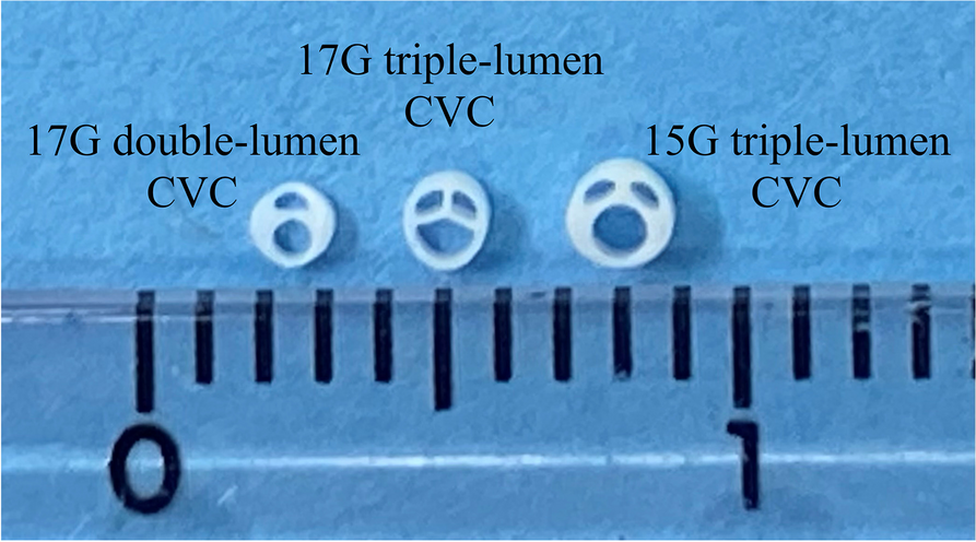 Vulnerability to bending and occlusion of distal lumen of the 17G triple-lumen central venous catheter