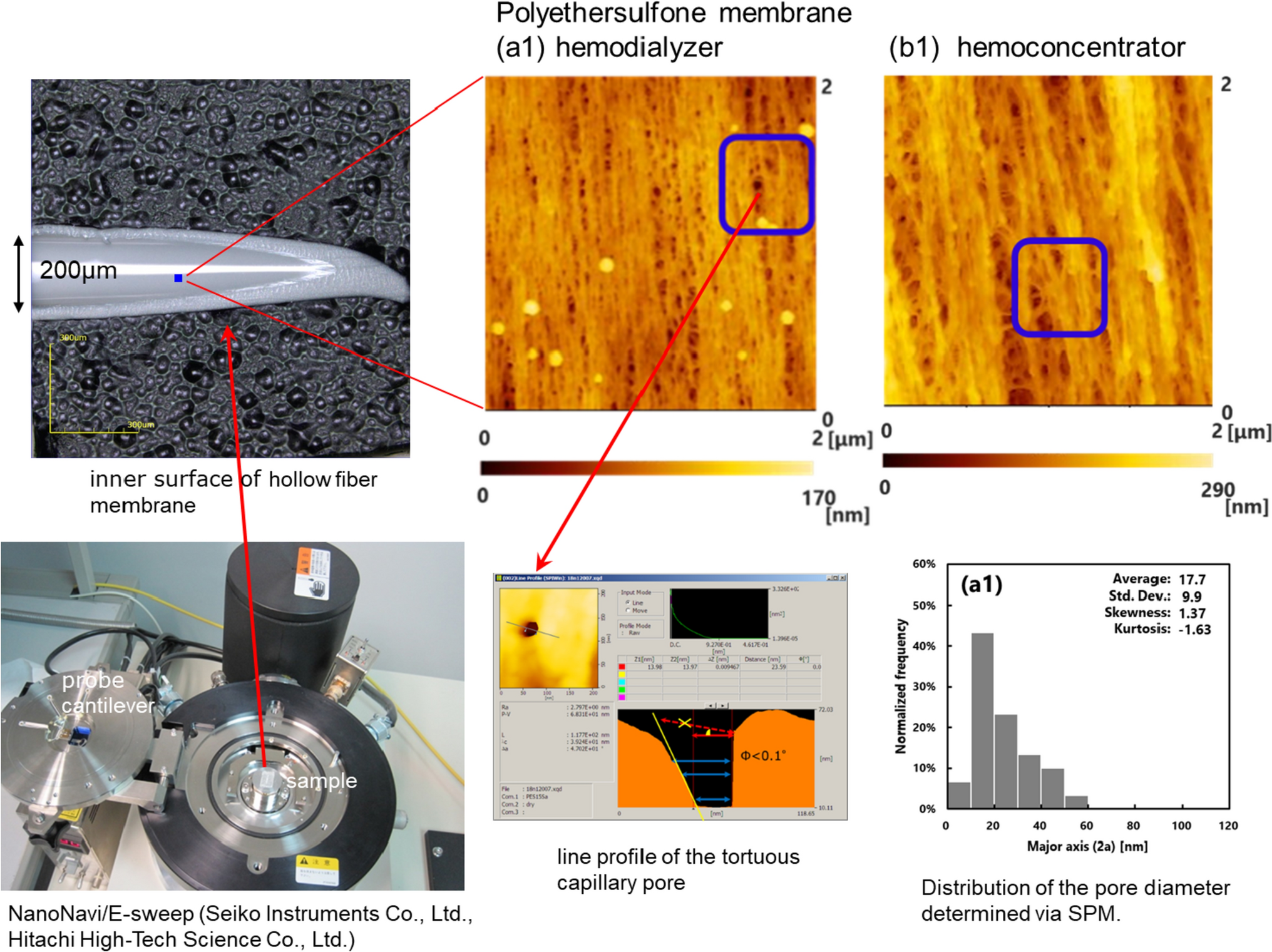 3D porous structure imaging of membranes for medical devices using scanning probe microscopy and electron microscopy: from membrane science points of view