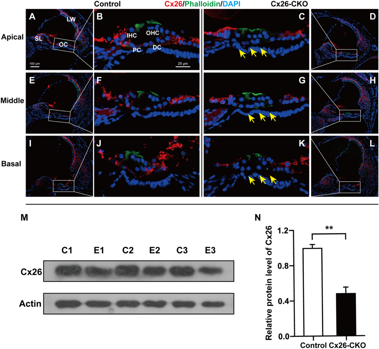 Abnormal Innervation, Demyelination, and Degeneration of Spiral Ganglion Neurons as Well as Disruption of Heminodes are Involved in the Onset of Deafness in Cx26 Null Mice