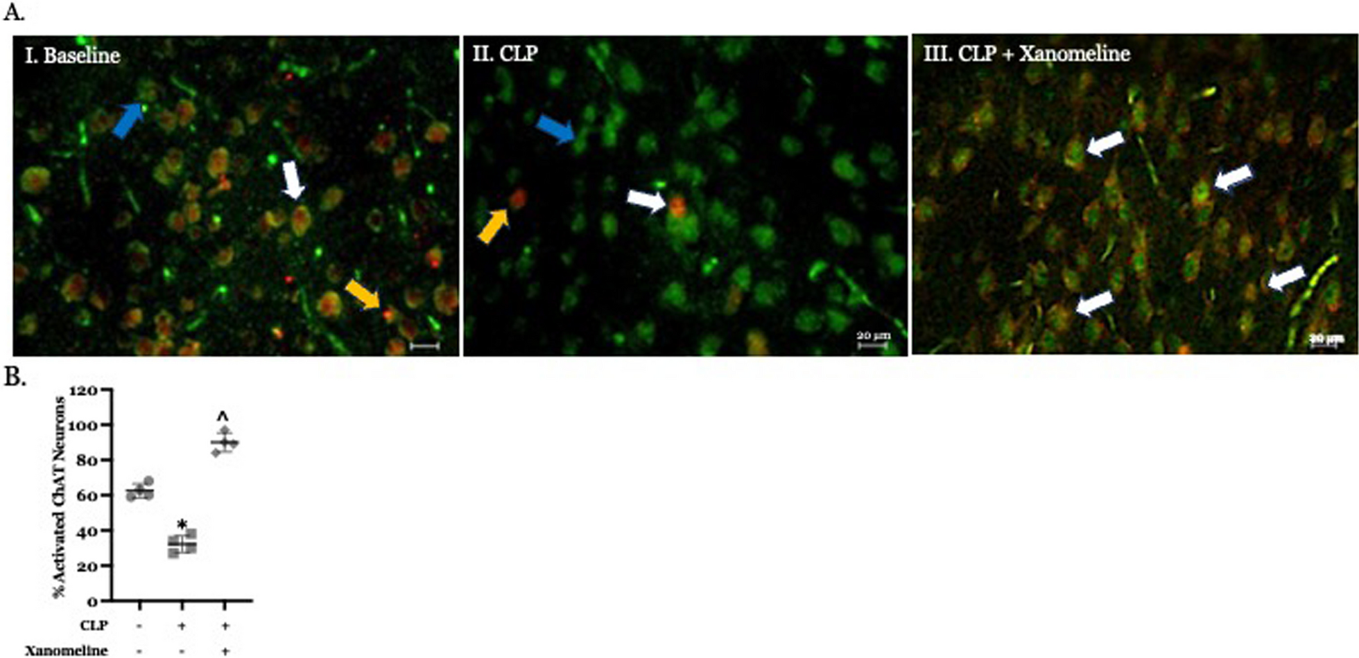 M1 cholinergic signaling in the brain modulates cytokine levels and splenic cell sub-phenotypes following cecal ligation and puncture