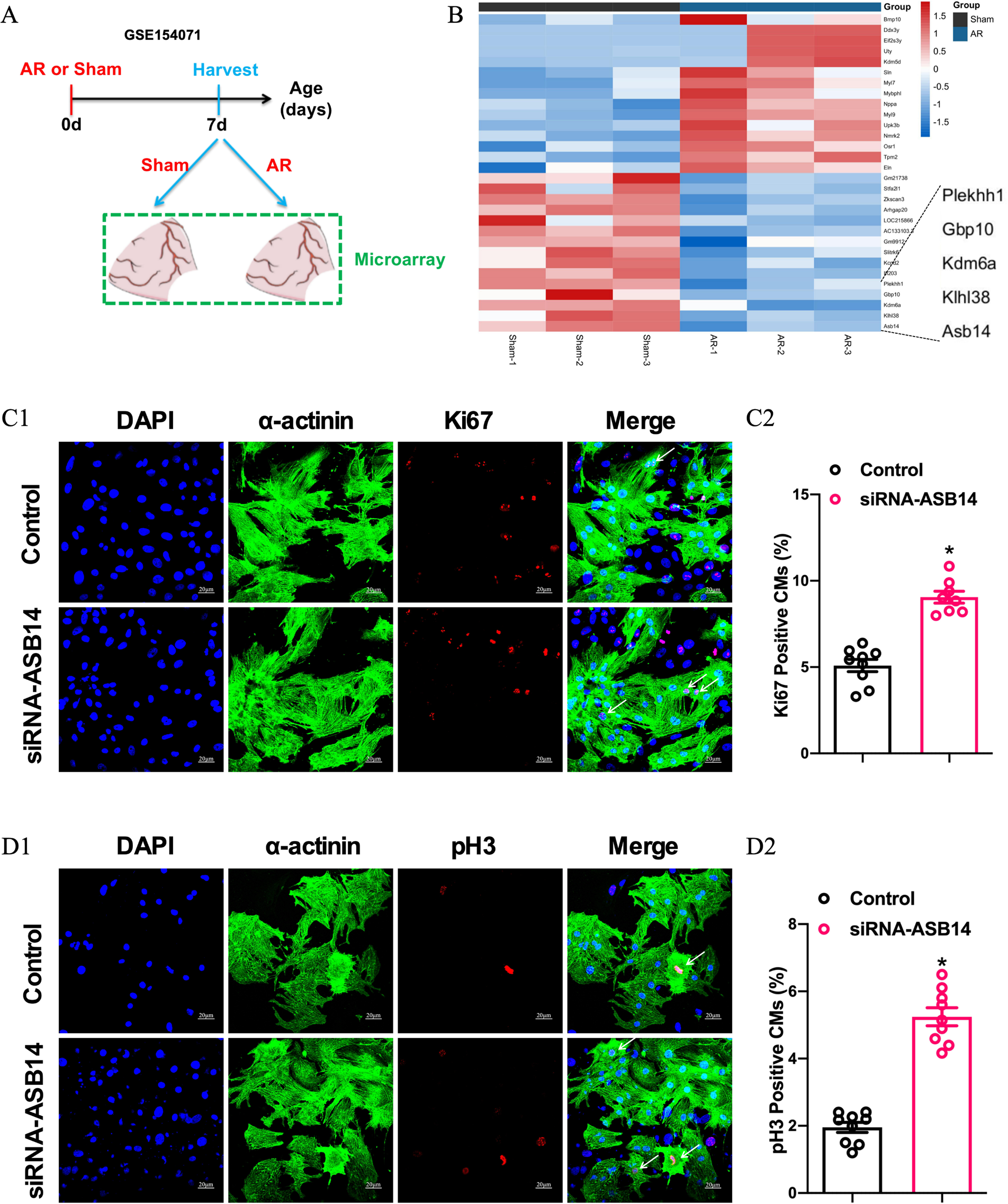 E3 Ubiquitin Ligase ASB14 Inhibits Cardiomyocyte Proliferation by Regulating MAPRE2 Ubiquitination