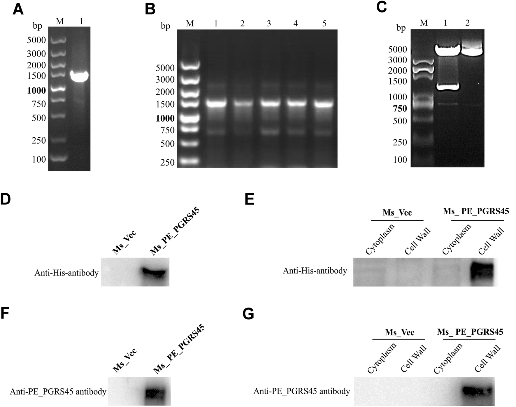 Mycobacterium tuberculosis PE_PGRS45 (Rv2615c) Promotes Recombinant Mycobacteria Intracellular Survival via Regulation of Innate Immunity, and Inhibition of Cell Apoptosis