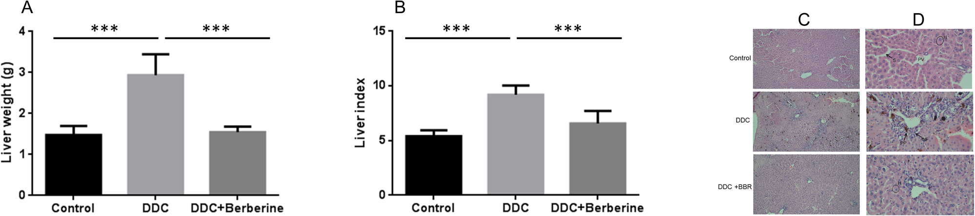 Berberine ameliorates the progression of primary sclerosing cholangitis by activating farnesoid X receptor