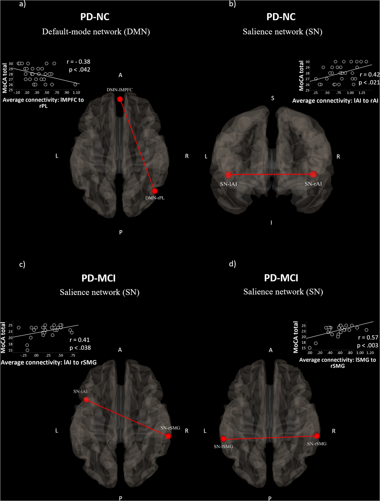 Resting-state networks and their relationship with MoCA performance in PD patients