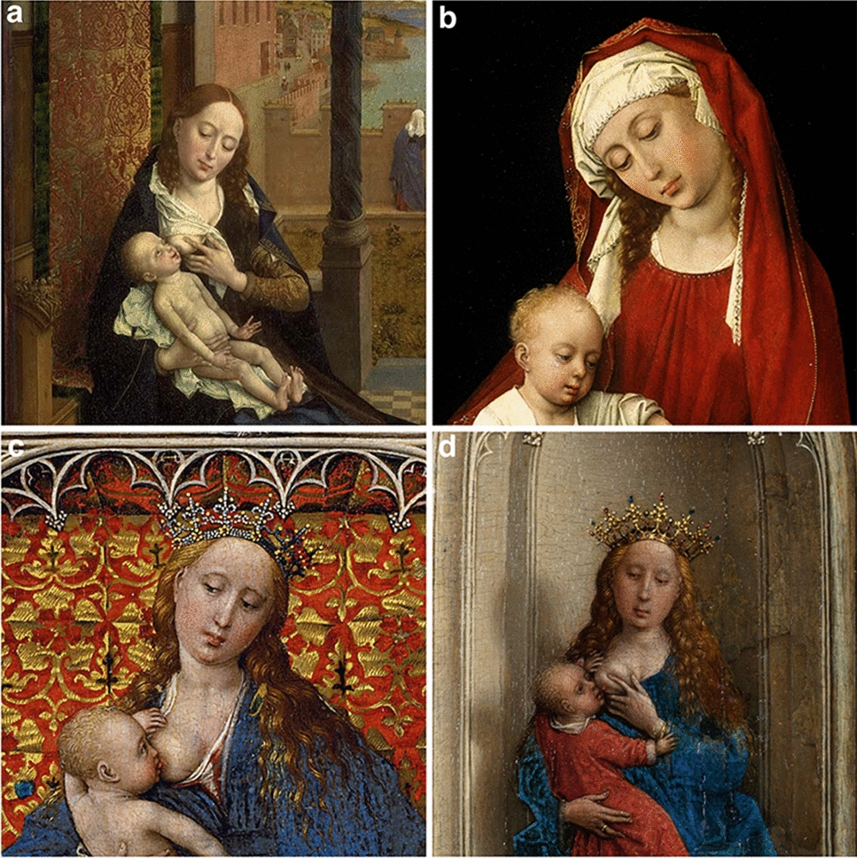 Goiter in the paintings by Rogier van der Weyden (1399–1464)