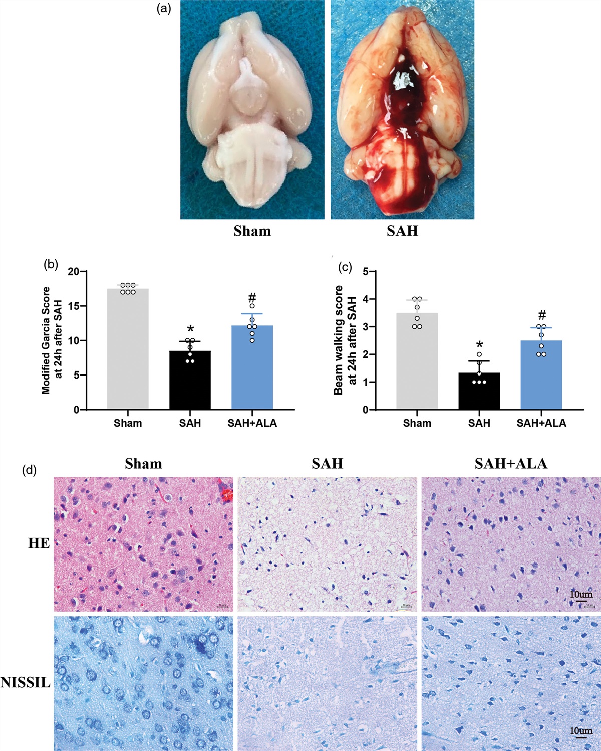 Alpha-lipoic acid (ALA) ameliorates early brain injury after subarachnoid hemorrhage in Sprague–Dawley (SD) rats via inhibiting STING-NLRP3 inflammatory signaling