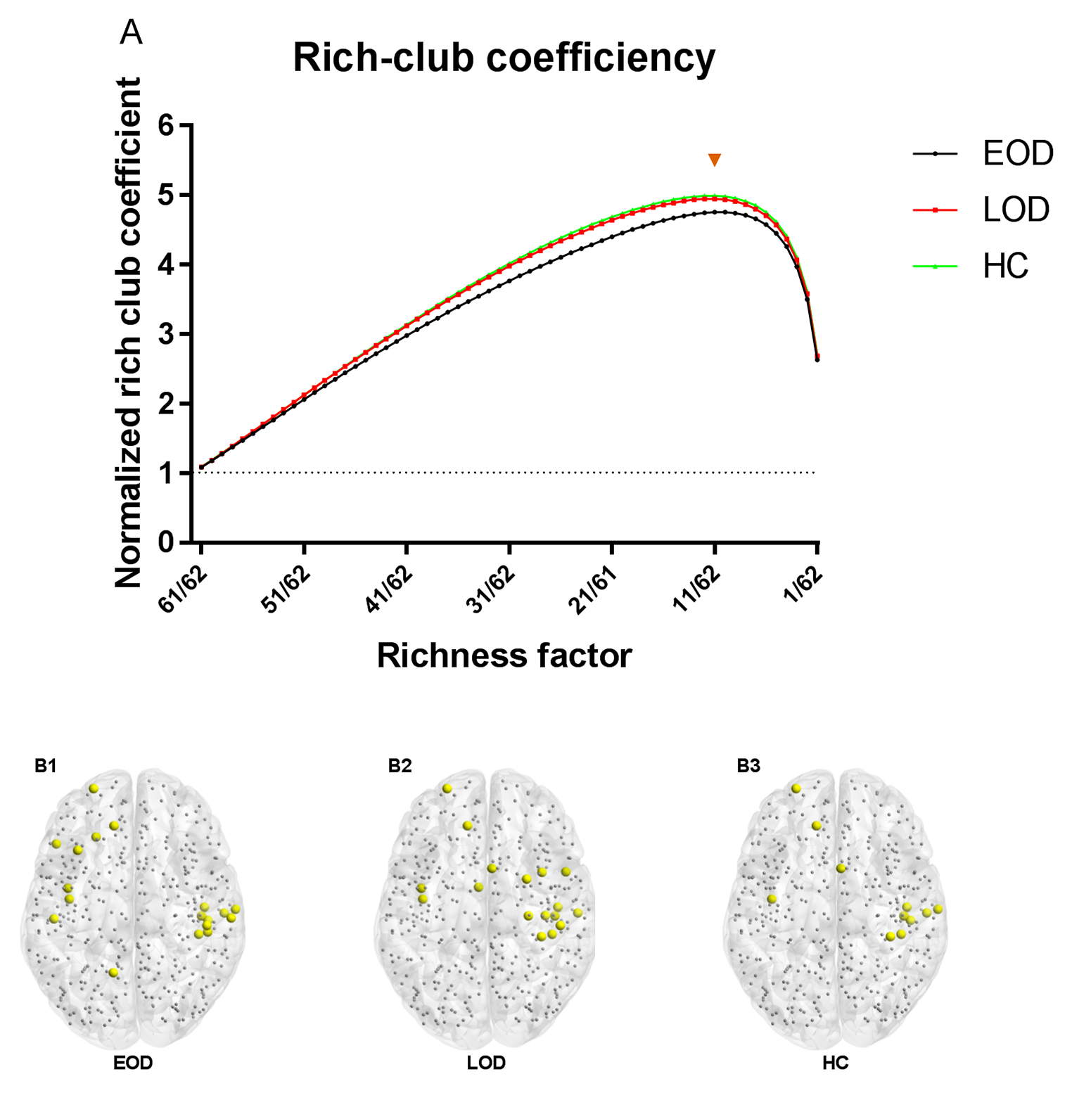 Increasing variance of rich-club nodes distribution in early onset depression according to dynamic network