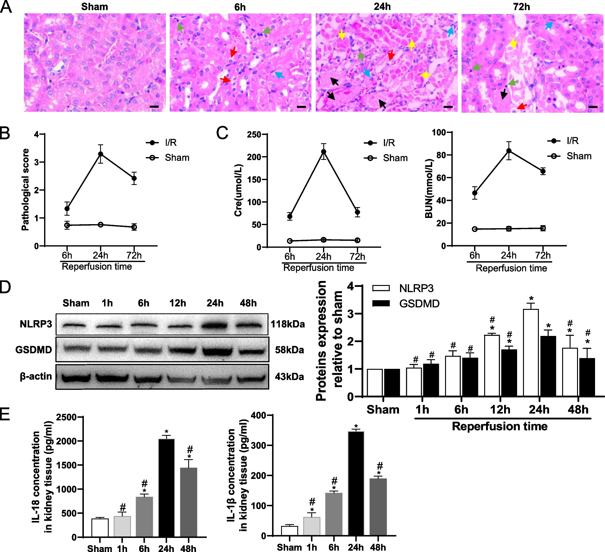 Connexin32 gap junction channels deliver miR155-3p to mediate pyroptosis in renal ischemia-reperfusion injury
