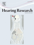 Processing of auditory novelty in human cortex during a semantic categorization task