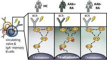 Aberrant B cell receptor signaling in circulating naïve and IgA+ memory B cells from newly-diagnosed autoantibody-positive rheumatoid arthritis patients
